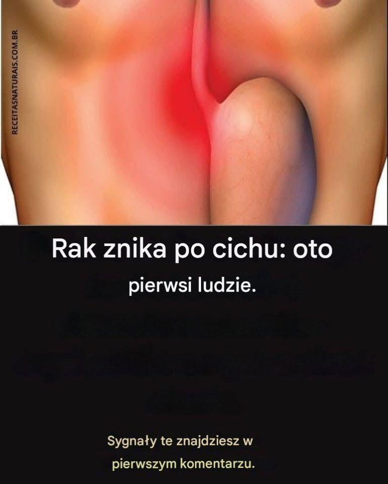 Rak__o__dka_rozwija_si__po_cichu__oto_pierwsze_objawy_-1
