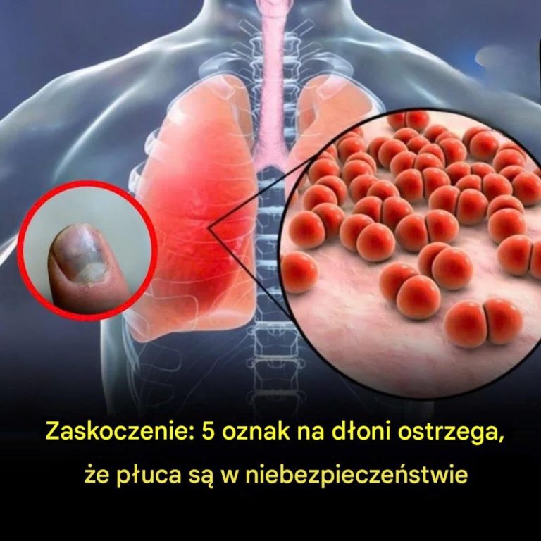 Twoje_d_onie_mog__ujawnia__powa_ne_problemy_z_p_ucami__a_Ty_mo_esz_o_tym_nie_wiedzie_