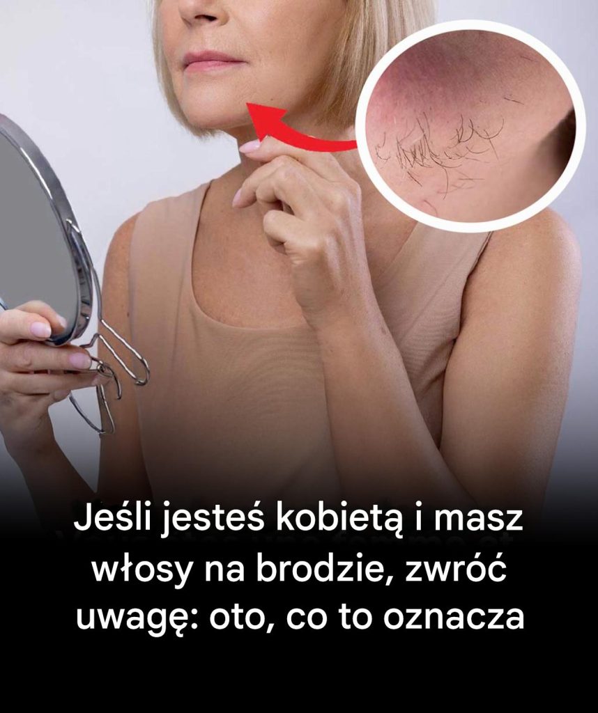 W_oski_na_brodzie_u_kobiet__co_mog__oznacza__ W_oski_na_brodzie_u_kobiet__co_mog__oznacza__