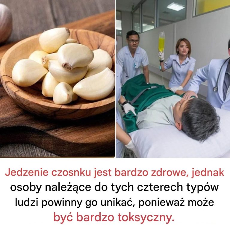 Wp_yw_czosnku_na_zdrowie__spo_ywa__z_umiarem_