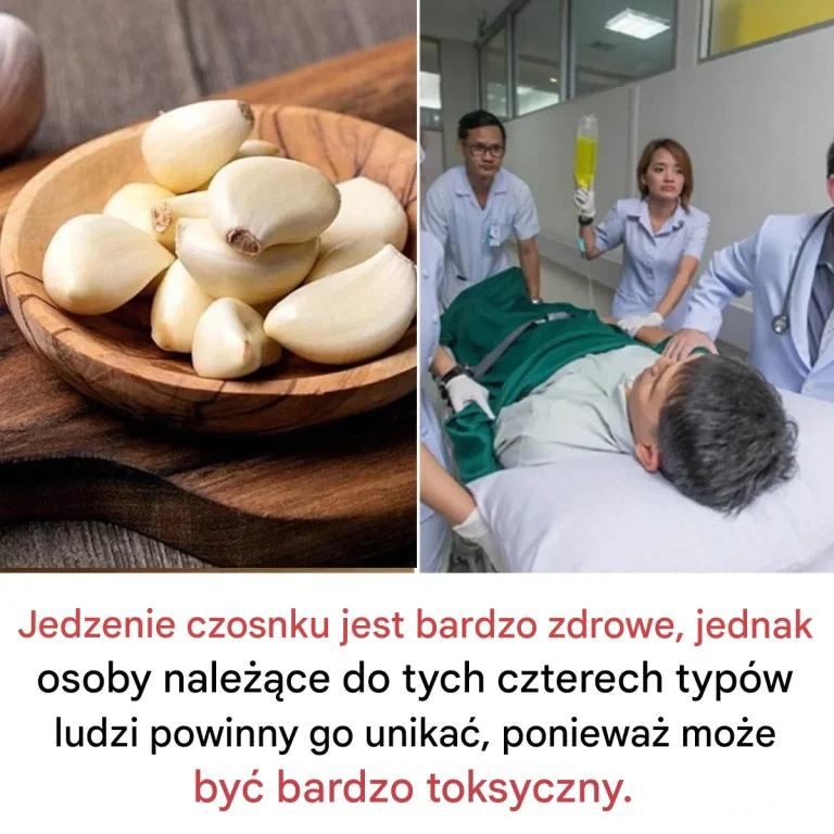 Wp_yw_czosnku_na_zdrowie__spo_ywa__z_umiarem_