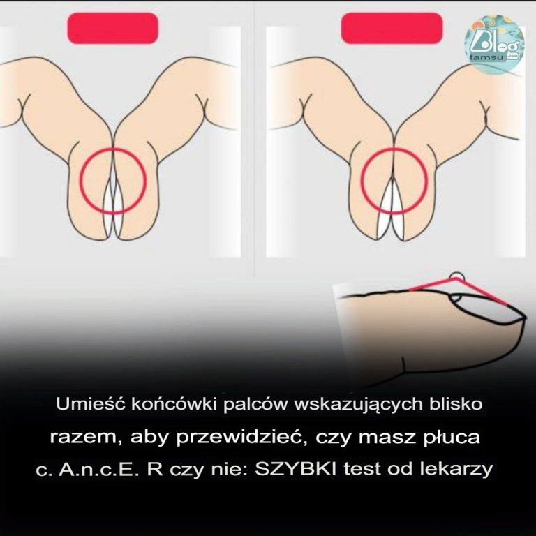 Z____ko_c_wki_palc_w_wskazuj_cych_blisko_siebie