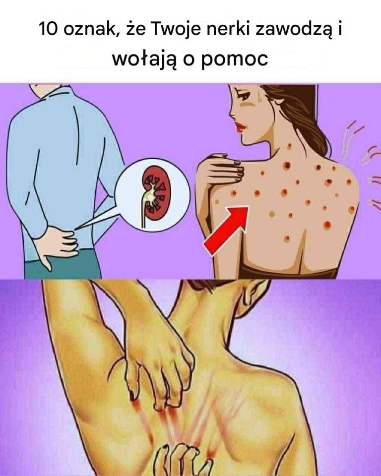 10_ostrzegawczych_znak_w___e_Twoje_nerki_mog__by__zagro_one