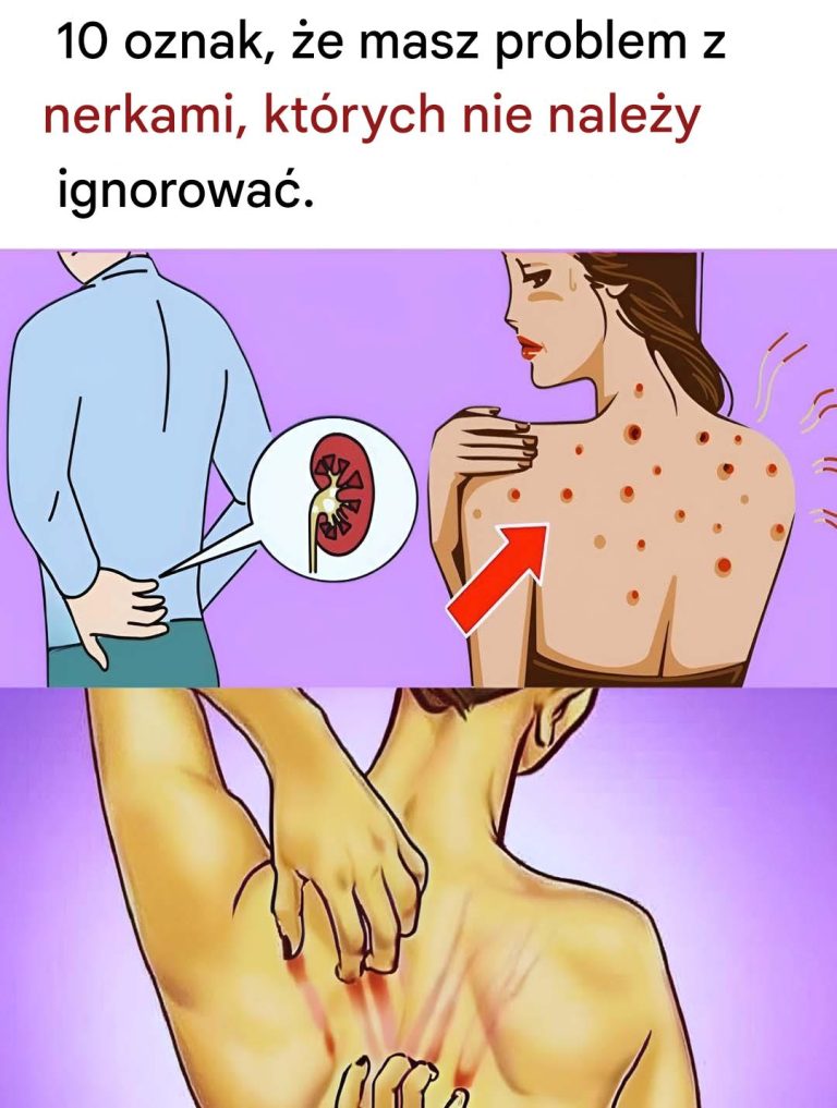 10_oznak___e_masz_problem_z_nerkami__kt_rych_nie_nale_y_ignorowa__