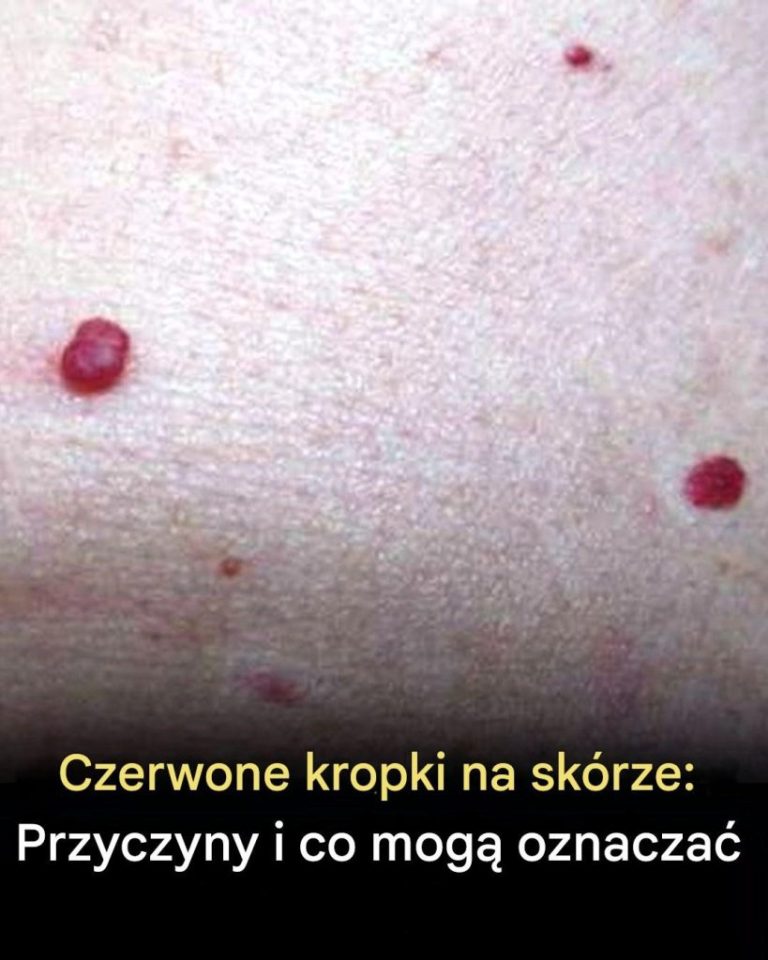 11_powod_w__dla_kt_rych_na_sk_rze_pojawiaj__si__czerwone_plamy