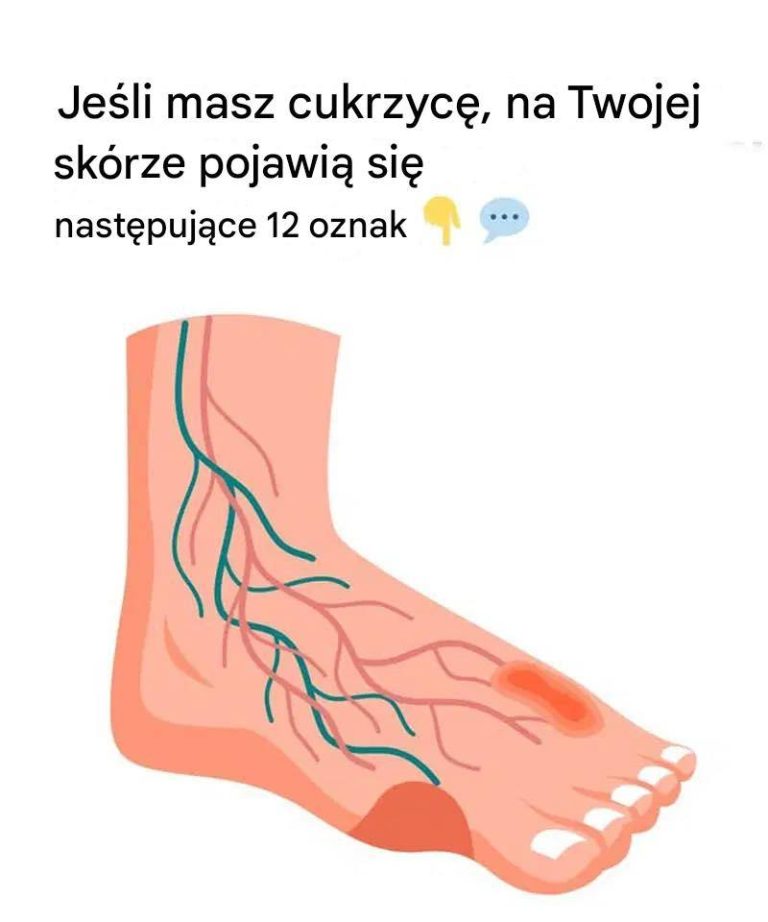 12_dziwnych_problem_w_sk_rnych_zwi_zanych_z_cukrzyc___o_kt_rych_musisz_wiedzie_