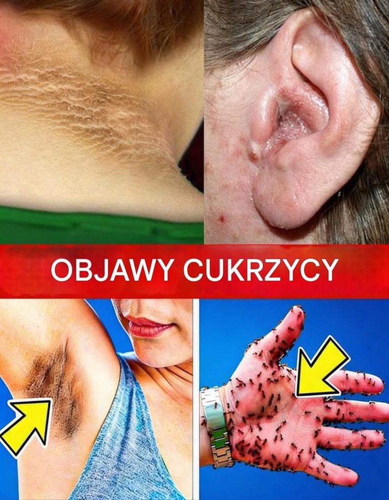 15_wczesnych_objaw_w_cukrzycy____8_mo_e_by___MIERTELNY__je_li_zostanie_zignorowany_