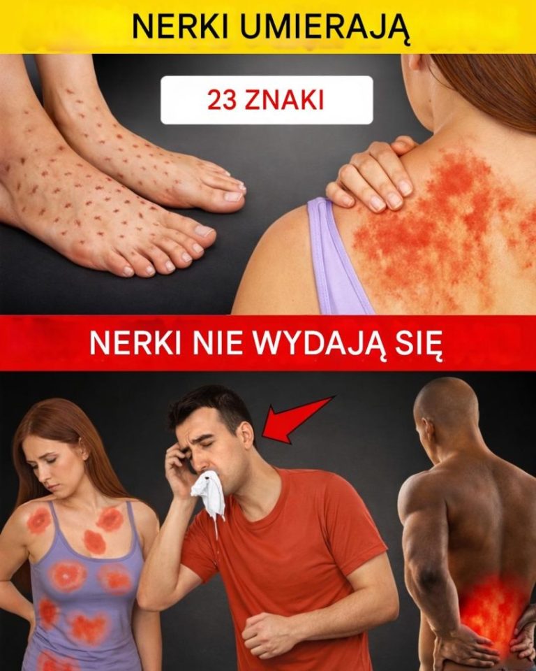 23_nietypowe_oznaki__kt_re_mog__wskazywa__na_problemy_z_nerkami__i_kiedy_zwr_ci__na_nie_uwag__