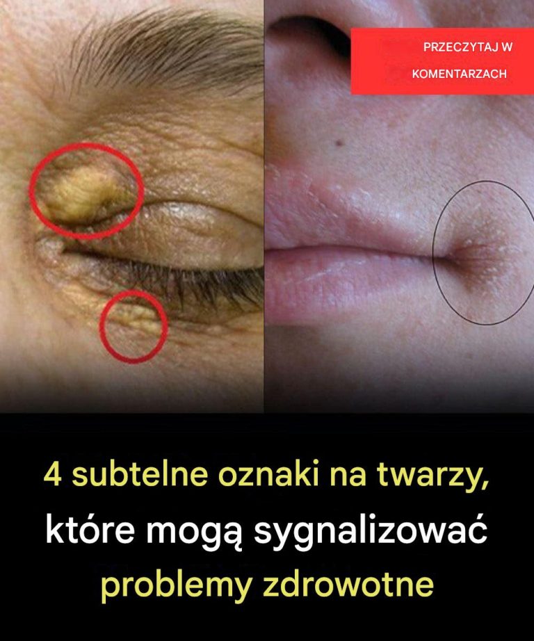 4_subtelne_oznaki_na_twarzy__kt_re_mog__sygnalizowa__problemy_zdrowotne4_subtelne_oznaki_na_twarzy__kt_re_mog__sygnalizowa__problemy_zdrowotne