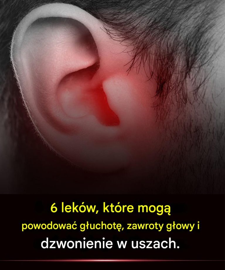 6_lek_w__kt_re_mog__powodowa__g_uchot___zawroty_g_owy_i_dzwonienie_w_uszach_