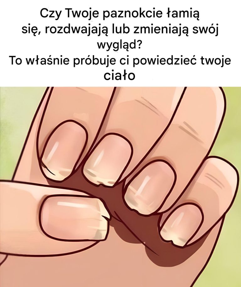 7_subtelnych_oznak_widocznych_na_paznokciach__kt_re_mog__wiele_powiedzie__o_Twoim_zdrowiu