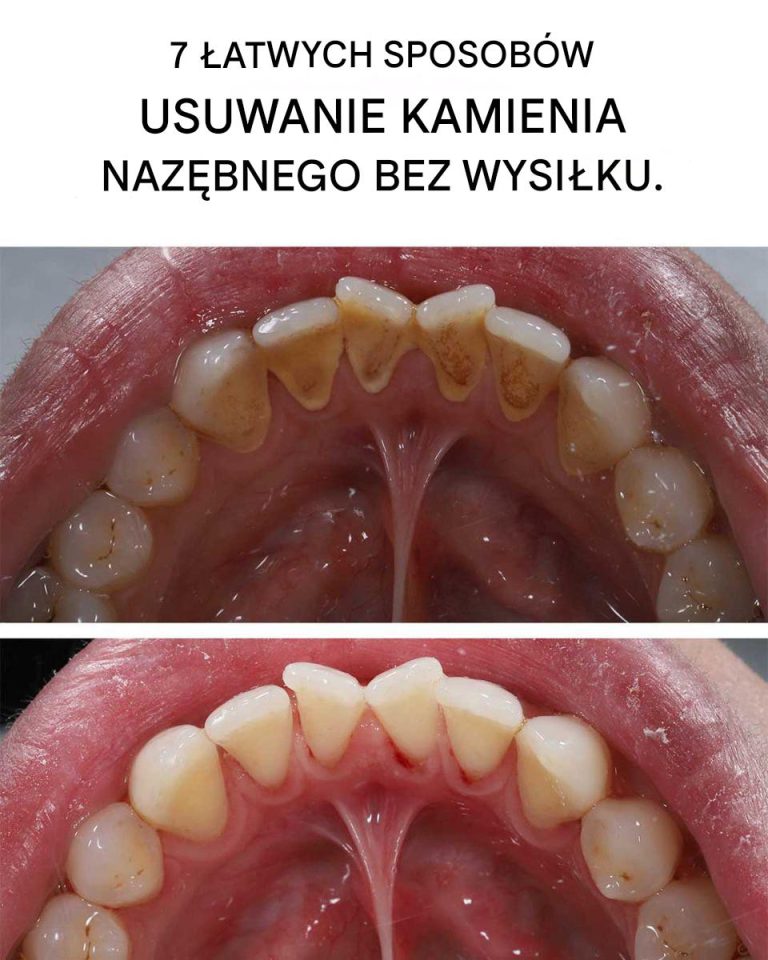 7_wskaz_wek__zdrowy_u_miech_bez_dentysty_