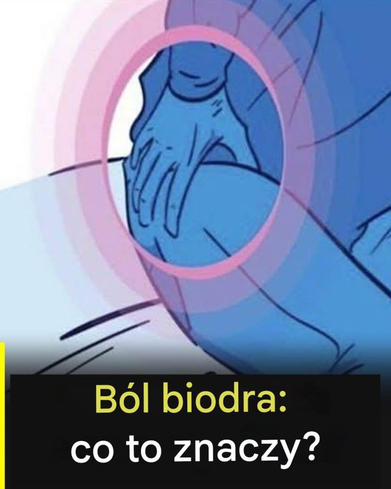 B_l_biodra__kiedy_dyskomfort_mo_e_by__czym__wi_cej_ni__tylko_zm_czeniem_