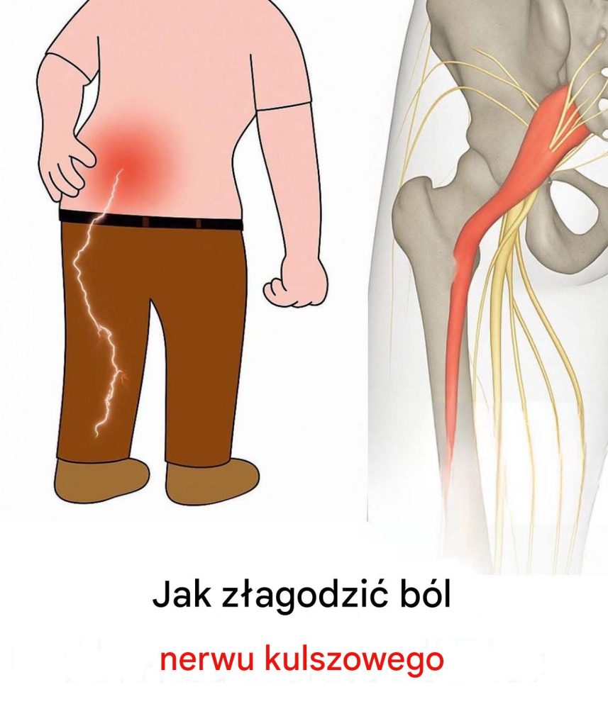 B_l_nerwu_kulszowego__3_proste__wiczenia__agodz_ce_dyskomfort_