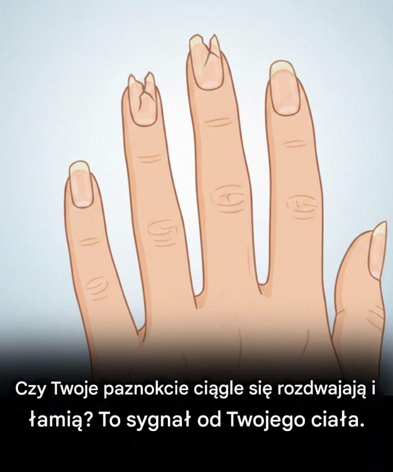 Czy_Twoje_paznokcie_wygl_daj__tak__Czas_na_wizyt__kontroln__