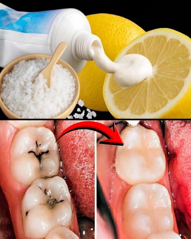 Czy_mo_na_naturalnie_wyleczy__pr_chnic___Prawda_o_remineralizacji__i_kiedy_czas_na_wizyt__u_dentysty_
