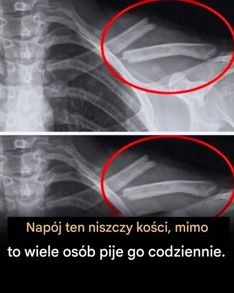 Czy_ten_p_yn_niszczy_ko_ci__Wiesz__o_jakim_napoju_m_wi__