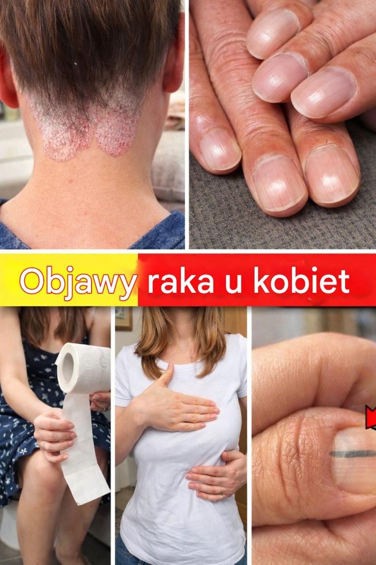 Dlaczego_te_objawy_s__wa_ne_dla_zdrowia_kobiet