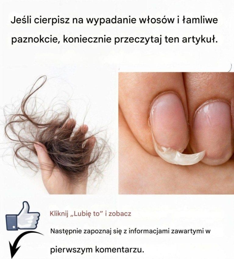 Dowiedz_si___jak_wyeliminowa__wypadanie_w_os_w_i_wzmocni__paznokcie