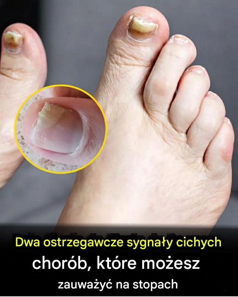 Dwa_ostrzegawcze_sygna_y_ukrytych_chor_b__kt_re_mo_esz_zauwa_y__na_swoich_stopach_-2