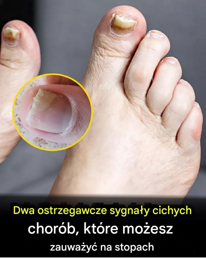 Dwa_ostrzegawcze_sygna_y_ukrytych_chor_b__kt_re_mo_esz_zauwa_y__na_swoich_stopach_-2