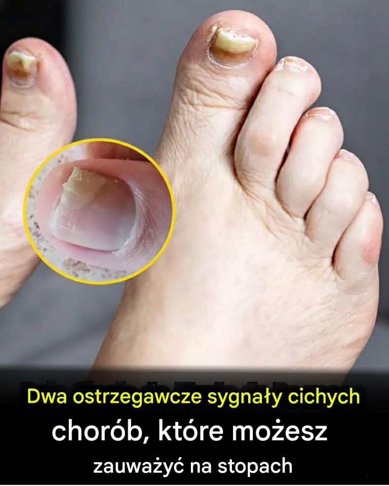 Dwa_ostrzegawcze_sygna_y_ukrytych_chor_b__kt_re_mo_esz_zauwa_y__na_swoich_stopach_