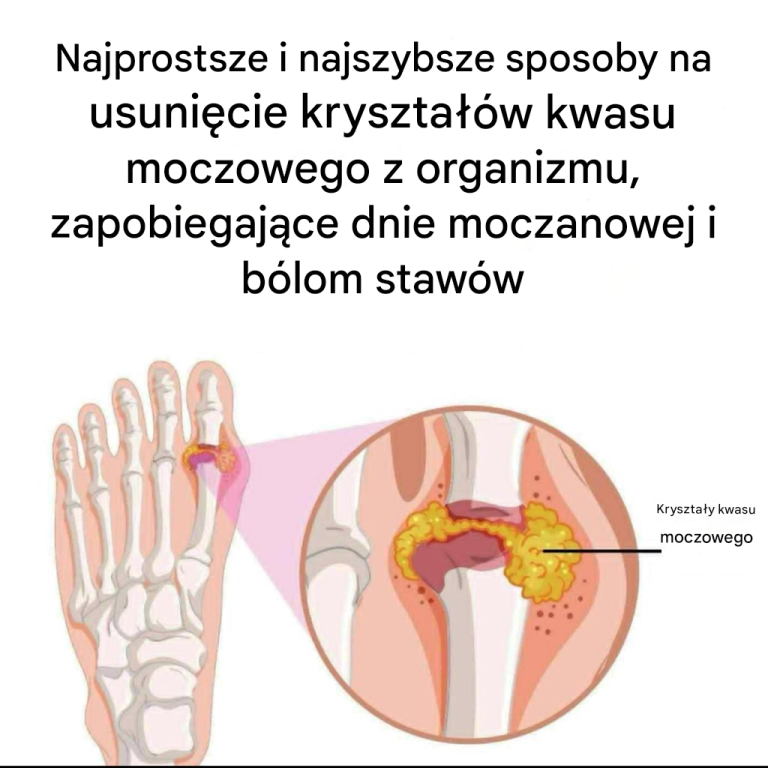 Jak_naturalnie_z_agodzi__dn__moczanow__i_b_l_staw_w