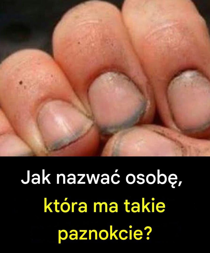 Jak_nazwa__osob___kt_ra_ma_takie_paznokcie_-1 Jak_nazwa__osob___kt_ra_ma_takie_paznokcie_-1