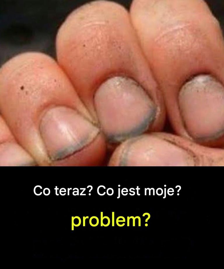Jak_si__nazywa_kto__z_takimi_paznokciami_-1