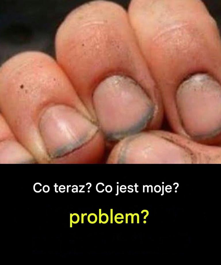 Jak_si__nazywa_kto__z_takimi_paznokciami_-3