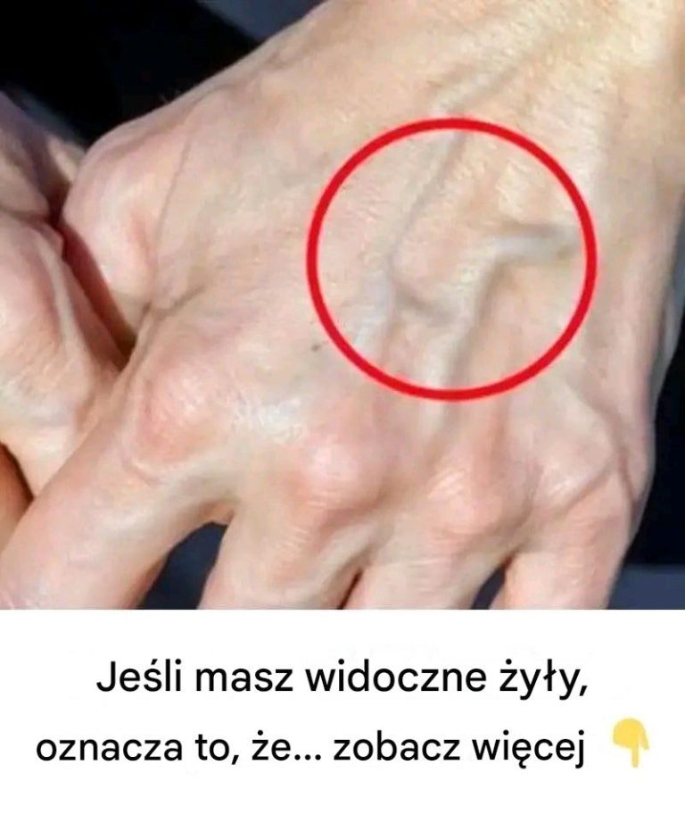 Je_li_na_Twojej_d_oni_widoczne_s___y_y__to_znak_