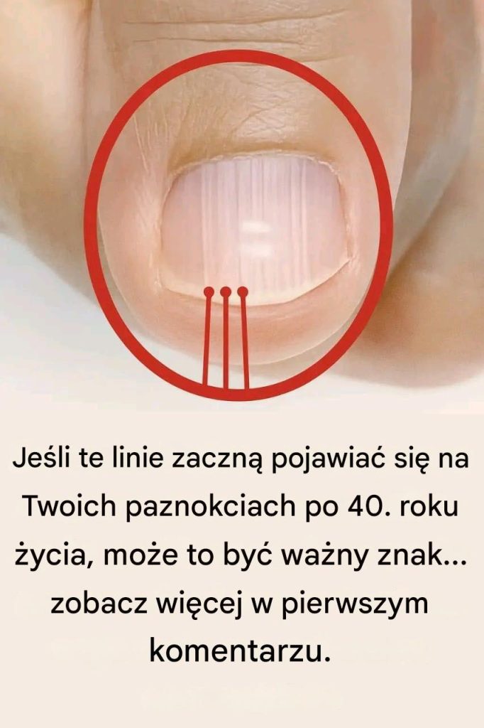 Je_li_po_40__roku__ycia_na_Twoich_paznokciach_zaczn__pojawia__si__linie__mo_e_to_by__znak_ostrzegawczy_