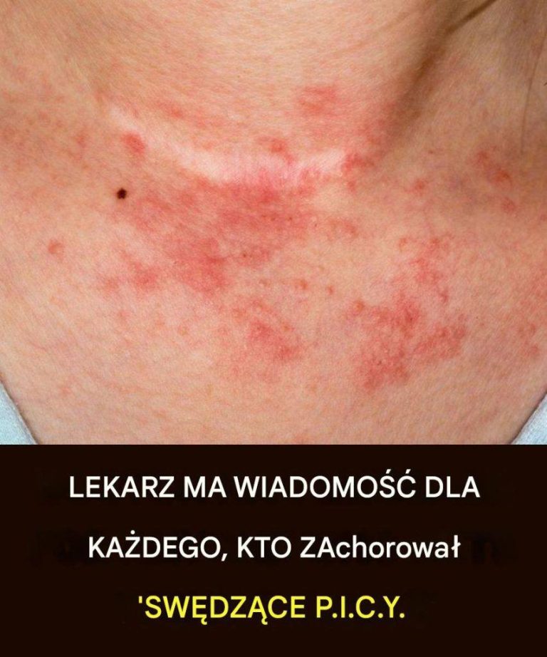Lekarz_ma_wiadomo___dla_wszystkich__kt_rych_sw_dz__piersi