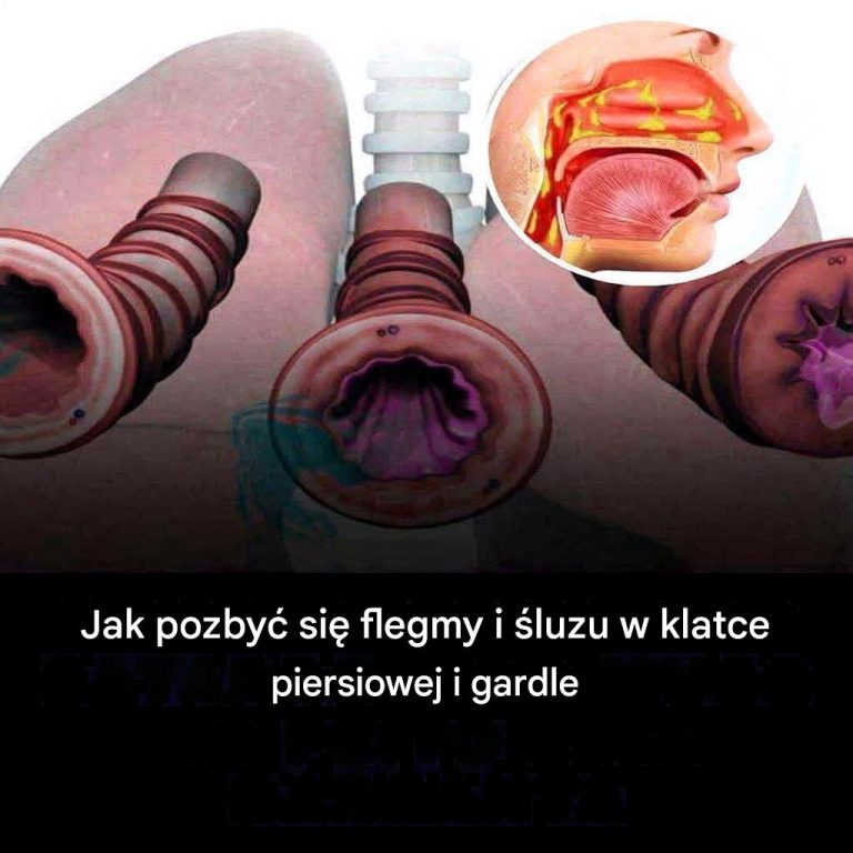 Na_szcz__cie_istnieje_szereg_rzeczy__kt_re_mo_esz_zrobi__w_domu__aby_pom_c_sobie_pozby__si__flegmy_i_lepiej_oddycha__