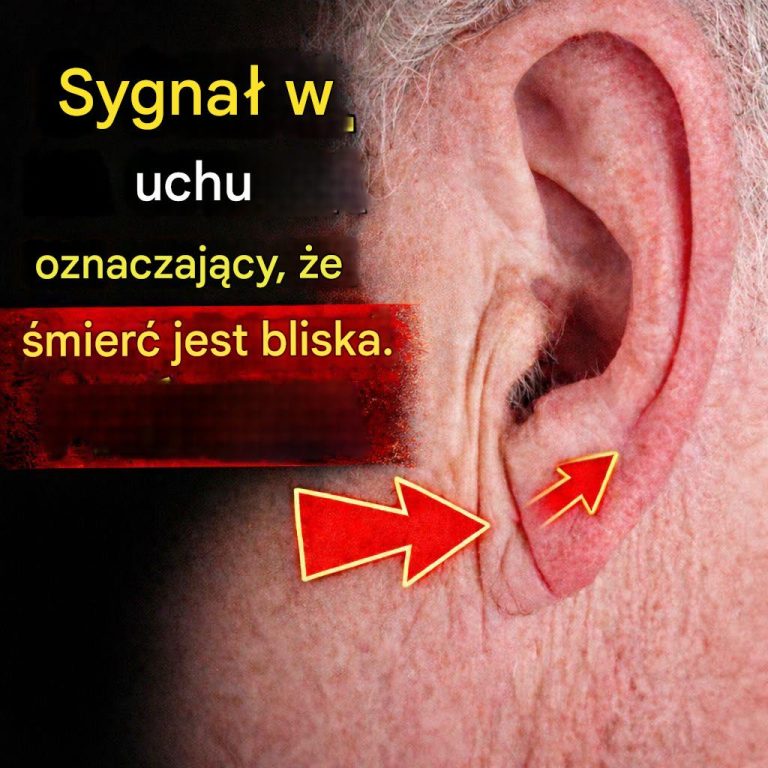 Objaw_Franka__fa_d_w_uchu__kt_ry_mo_e_by__zwi_zany_z_chorob__serca___i_kiedy_objaw_ten_wymaga_interwencji_lekarskiej_