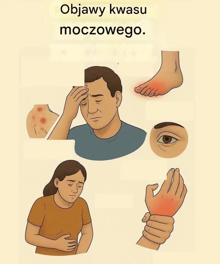 Obni_anie_poziomu_kwasu_moczowego