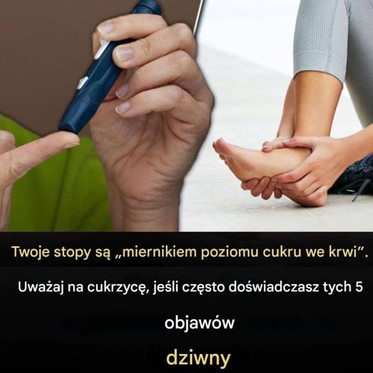 Oto_5_nietypowych_objaw_w_st_p