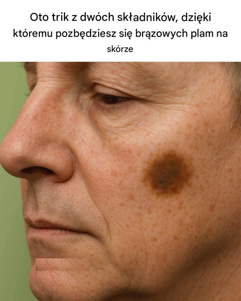 Oto_dwusk_adnikowy_trik_na_pozbycie_si__br_zowych_plam_na_sk_rze