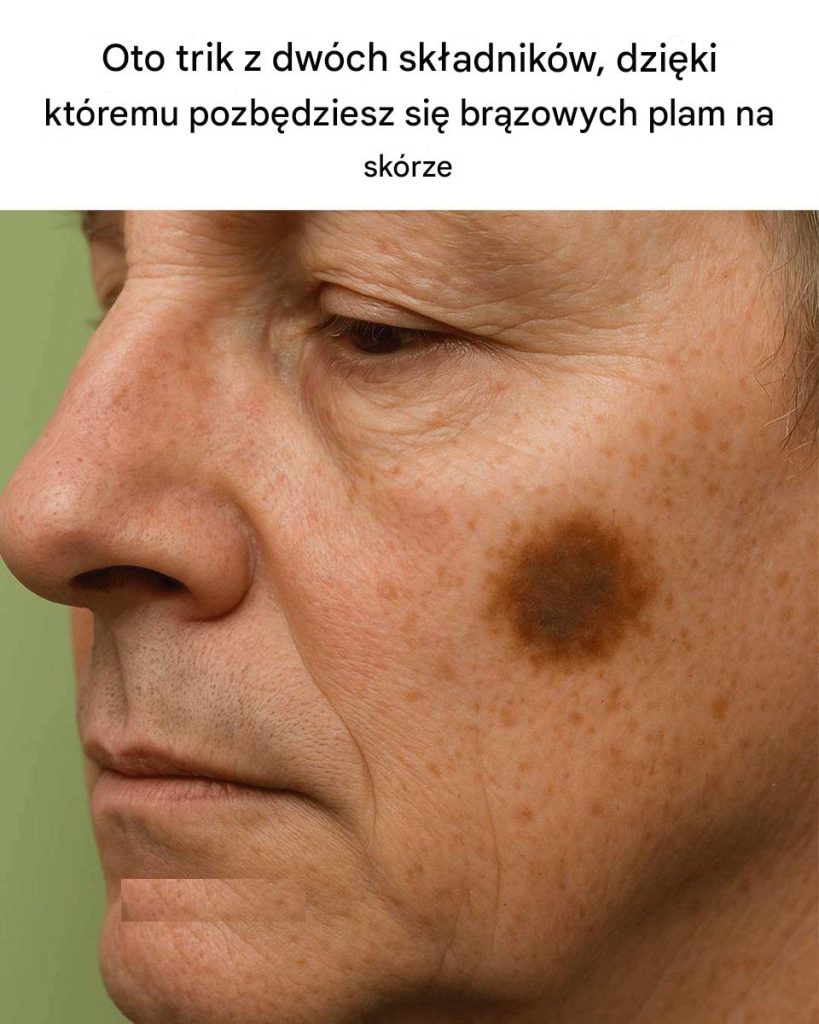 Oto_dwusk_adnikowy_trik_na_pozbycie_si__br_zowych_plam_na_sk_rze