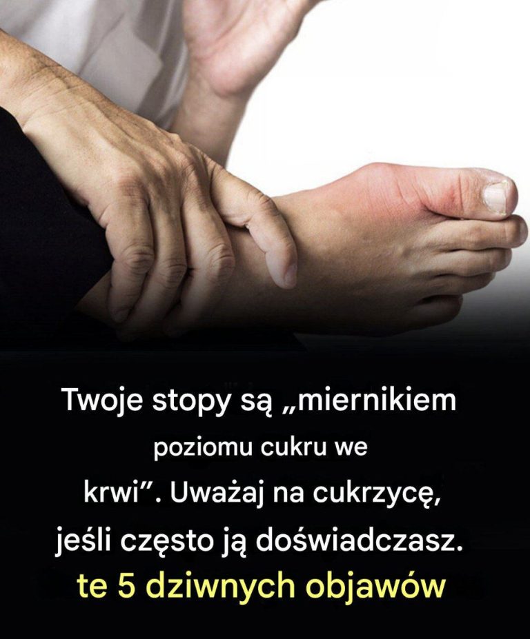 Oto_pi___nietypowych_objaw_w_st_p-1