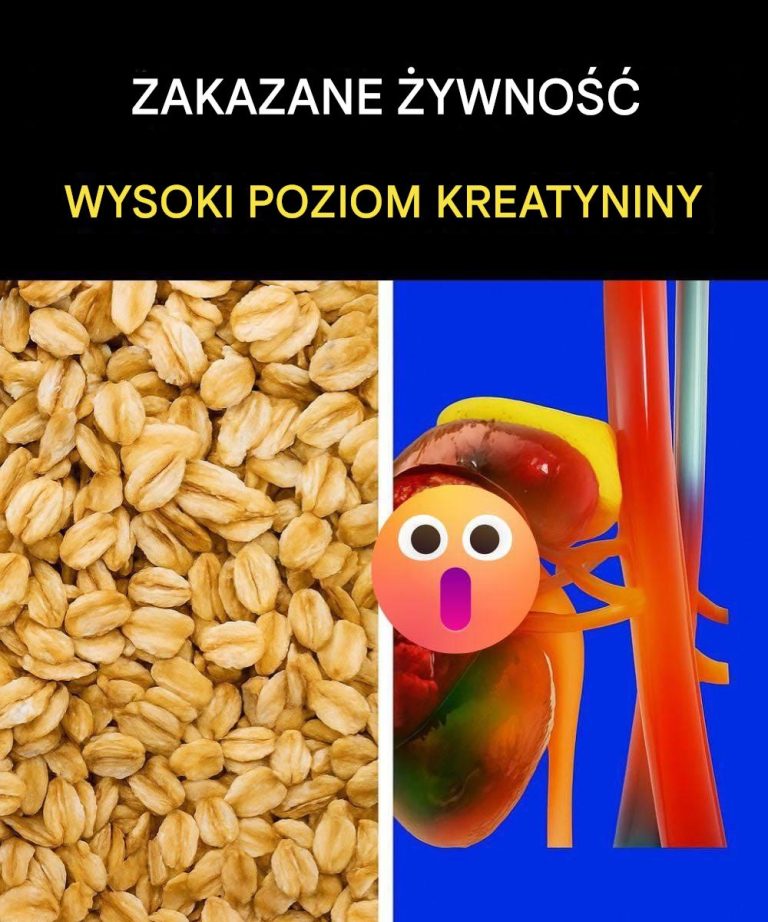 Produkty__kt_rych_nie_nale_y_spo_ywa__w_przypadku_wysokiego_poziomu_kreatyniny