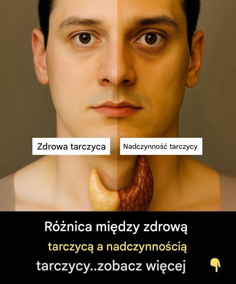 R__nica_mi_dzy_zdrow__tarczyc__a_nadczynno_ci__tarczycy