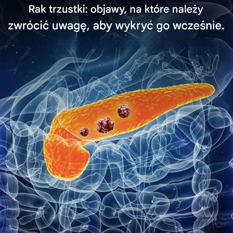 Rak_trzustki__objawy__na_kt_re_nale_y_zwr_ci__uwag___aby_wykry__go_wcze_nie_