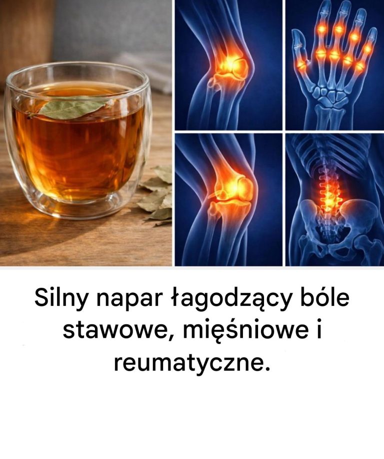 Silny_napar__agodz_cy_b_le_stawowe__mi__niowe_i_reumatyczne_