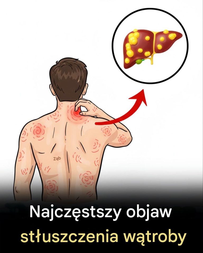 St_uszczenie_w_troby__przyczyny__objawy__leczenie_i_domowe_sposoby