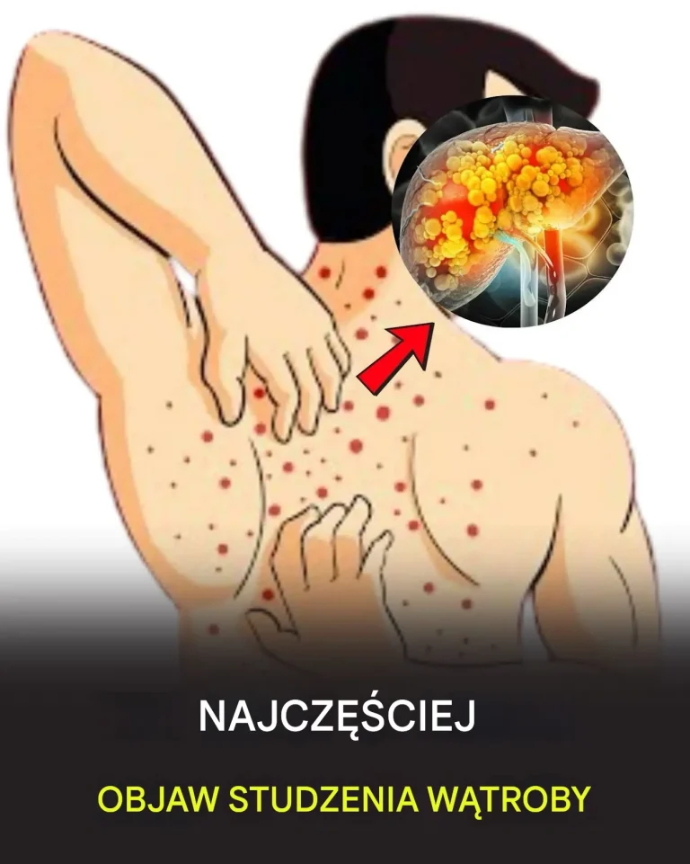 St_uszczenie_w_troby__przyczyny__objawy__leczenie_i_domowe_sposoby