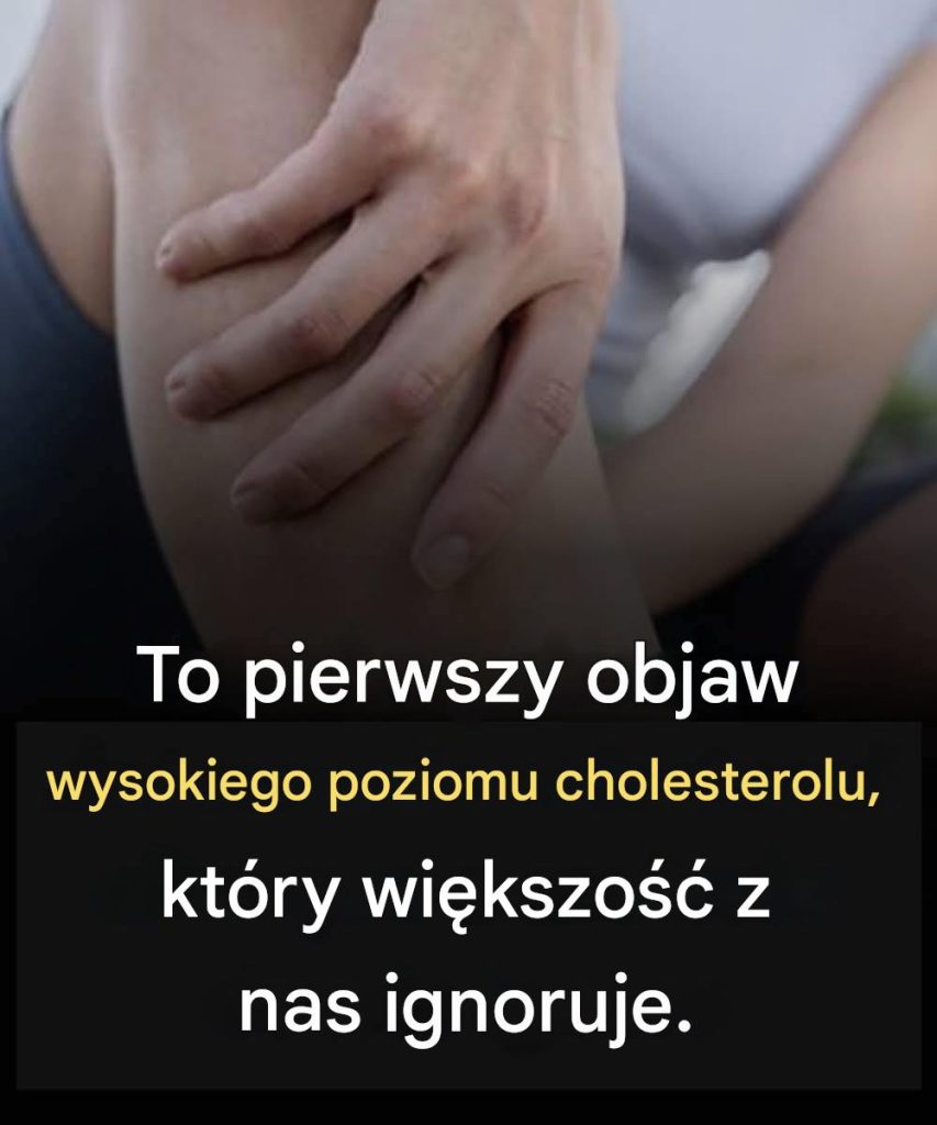 To_pierwszy_objaw_wysokiego_poziomu_cholesterolu__kt_ry_wiele_os_b_ignoruje_