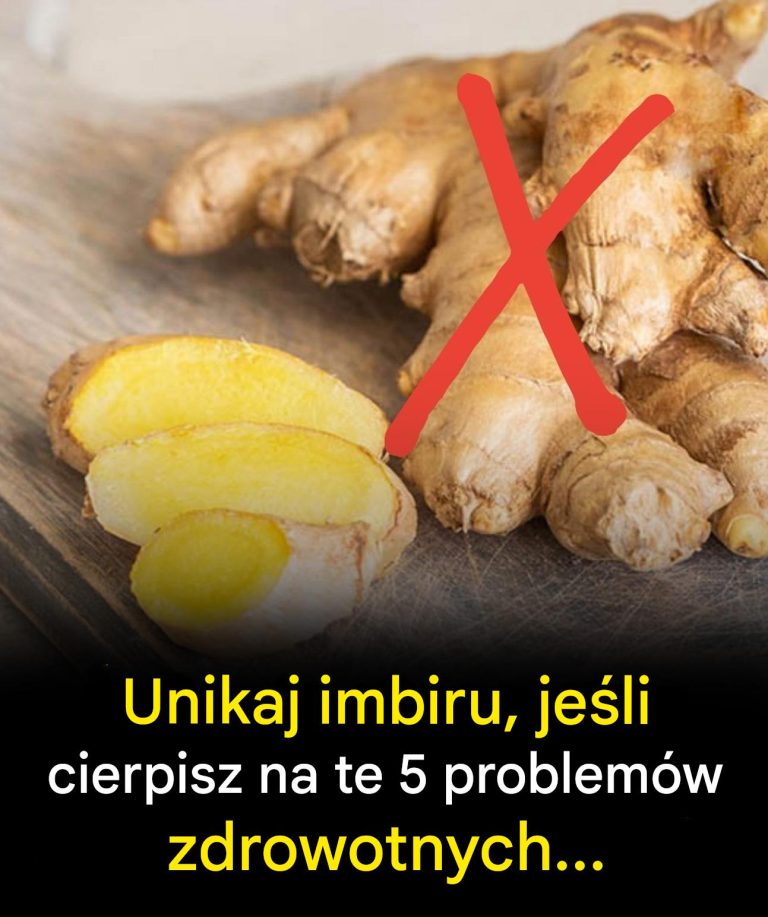 Unikaj_imbiru__je_li_cierpisz_na_te_5_problem_w_zdrowotnych__