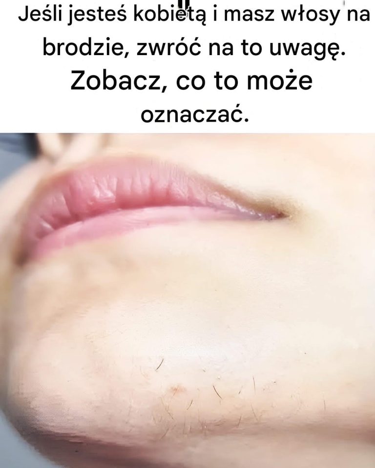 W_osy_na_brodzie_u_kobiet__co_to_oznacza_