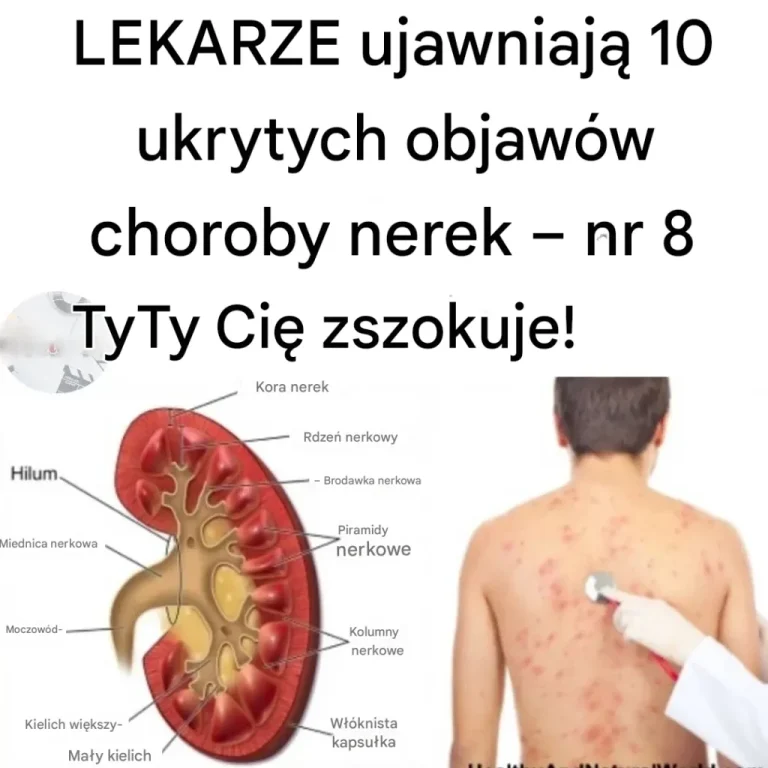 Wczesne_objawy_choroby_nerek_i_jak_chroni__nerki__oparte_na_dowodach_